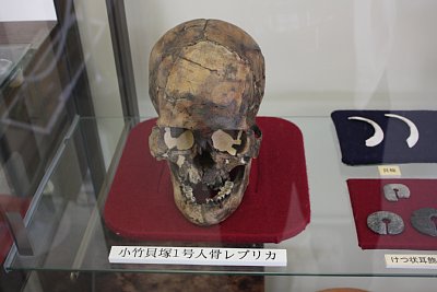 小竹貝塚から発掘された成人女性の頭骨